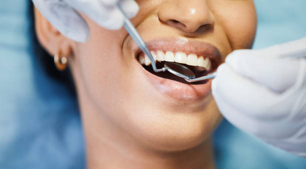 Best Emergency Broken Tooth Repair in Bondurant, IA